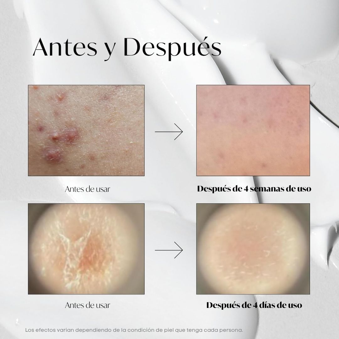 VT Cosmetics «VT Reedle Shot 100»