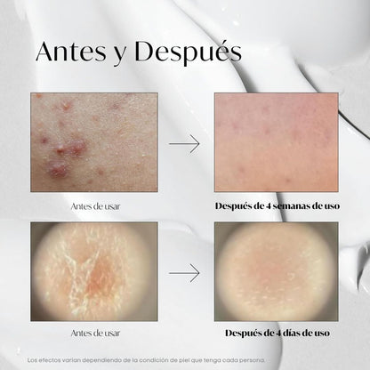 VT Cosmetics «VT Reedle Shot 300»