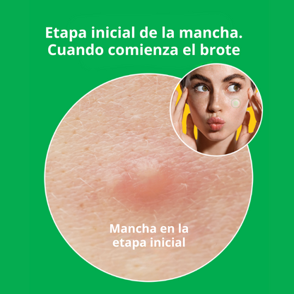 Nolahour Parche «Spot Eraser Green – Early Stage»