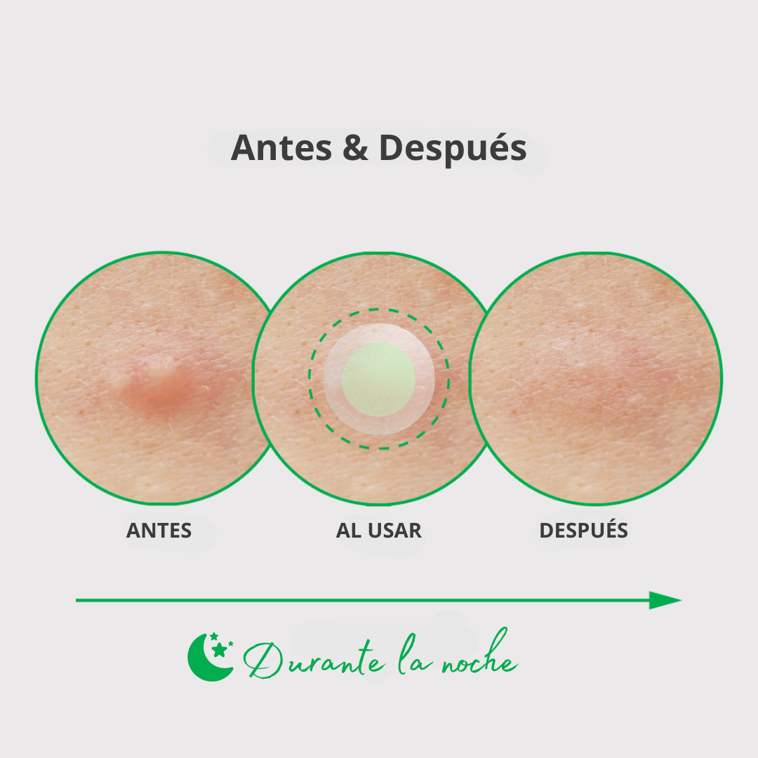 Nolahour Parche «Spot Eraser Green – Early Stage»