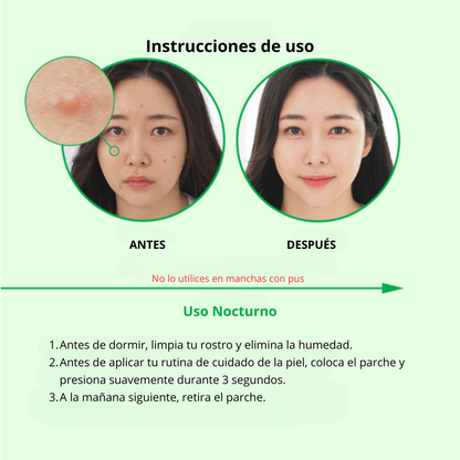 Nolahour Parche «Spot Eraser Green – Early Stage»