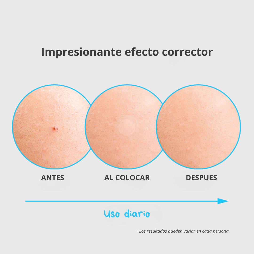 Nolahour Parche «Spot Eraser Blue – Spot Recovery»