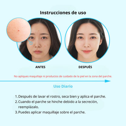 Nolahour Parche «Spot Eraser Blue – Spot Recovery»