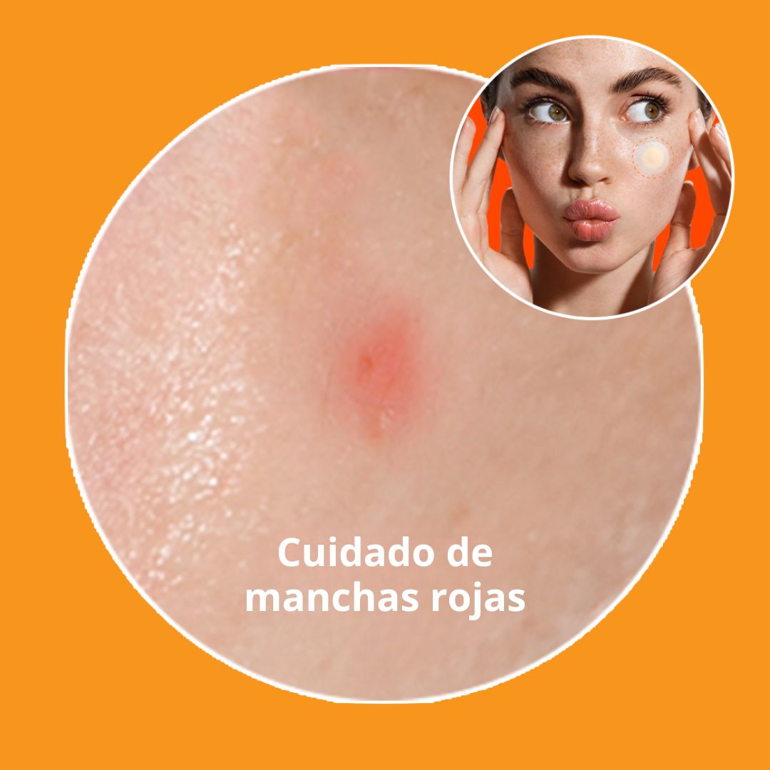 Nolahour Parche «Spot Eraser Orange – Red Spot»