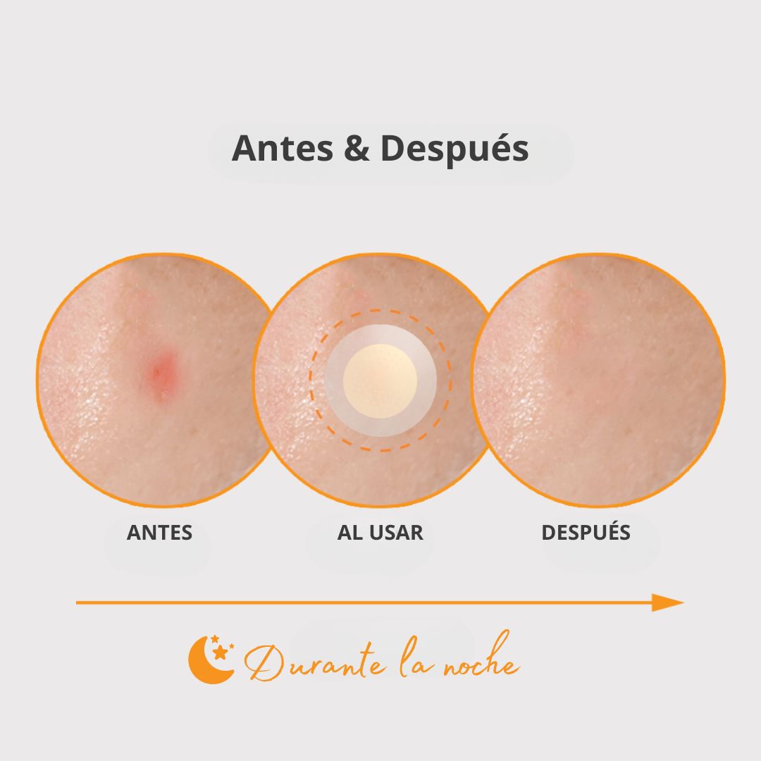 Nolahour Parche «Spot Eraser Orange – Red Spot»