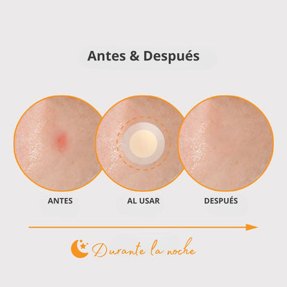 Nolahour Parche «Spot Eraser Orange – Red Spot»