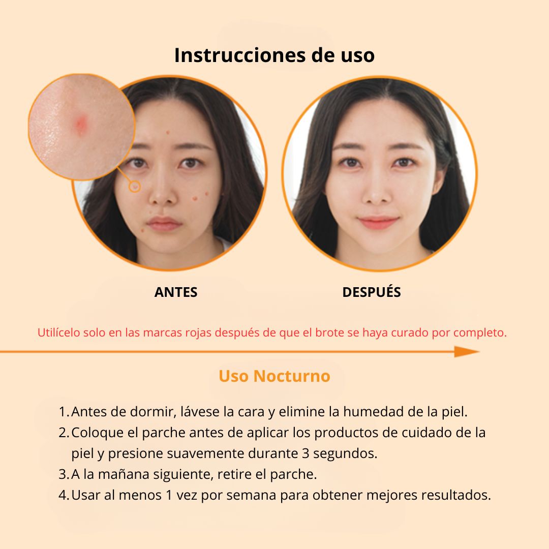 Nolahour Parche «Spot Eraser Orange – Red Spot»
